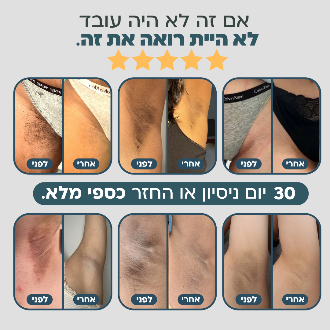 מארז ההבהרה של אניו