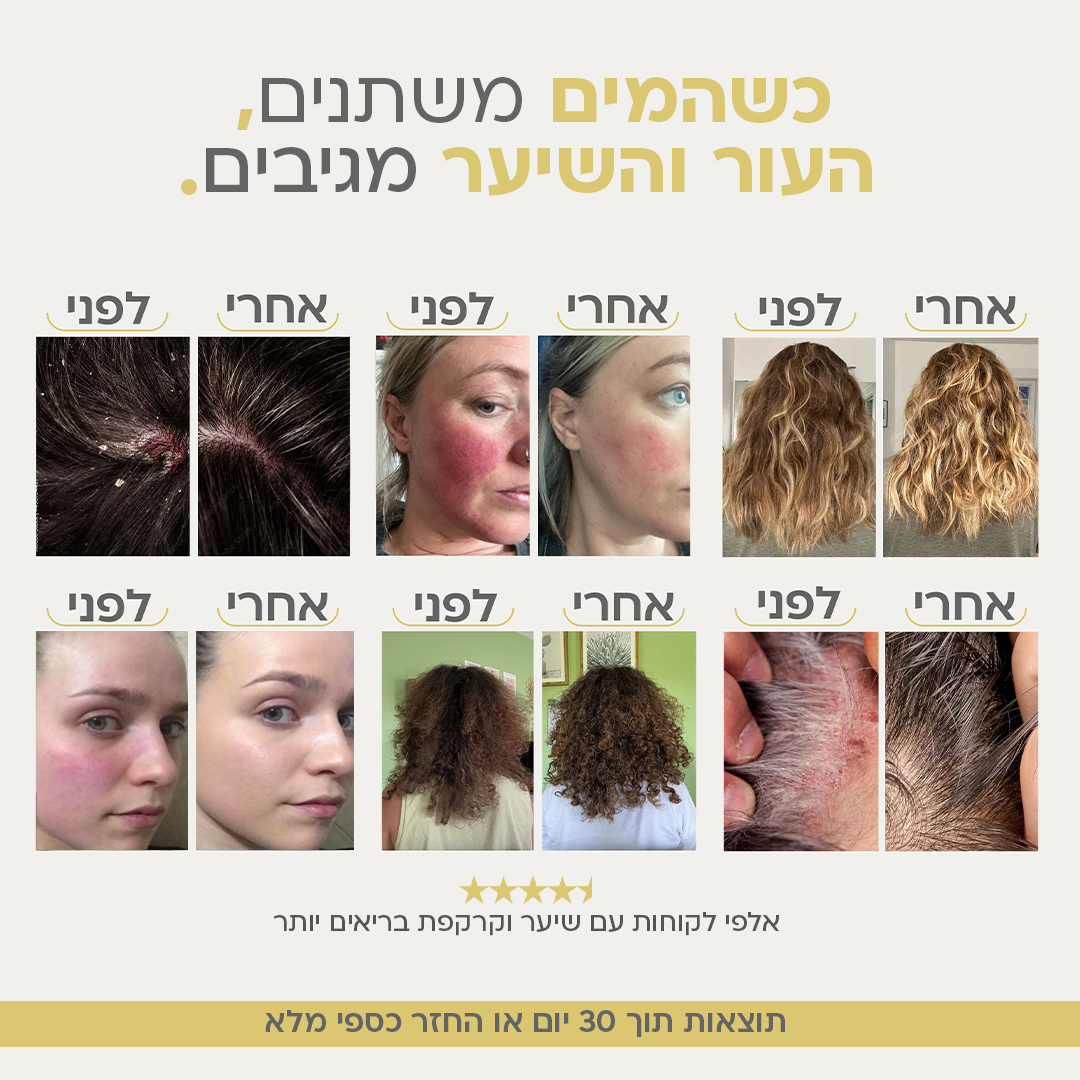 AQUAEN™ - ראש מקלחת מסנן מבית אניו